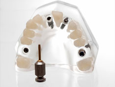 Implantat