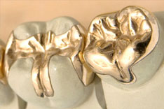 Goldinlay