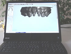 Cad-Cam System