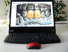 Cad-Cam System